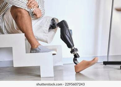 Lower Limb Prosthetics